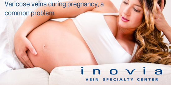 Varicose veins during pregnancy, a