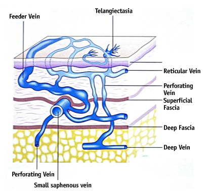 diagram of spider veins