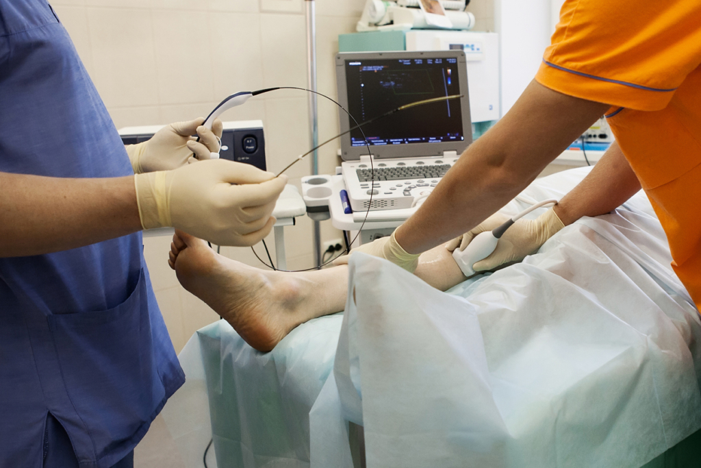 doctors use ultrasound on varicose vein