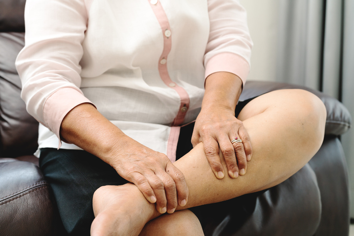 Woman holds legs with vein pain