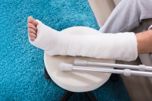 Leg Injury in Cast