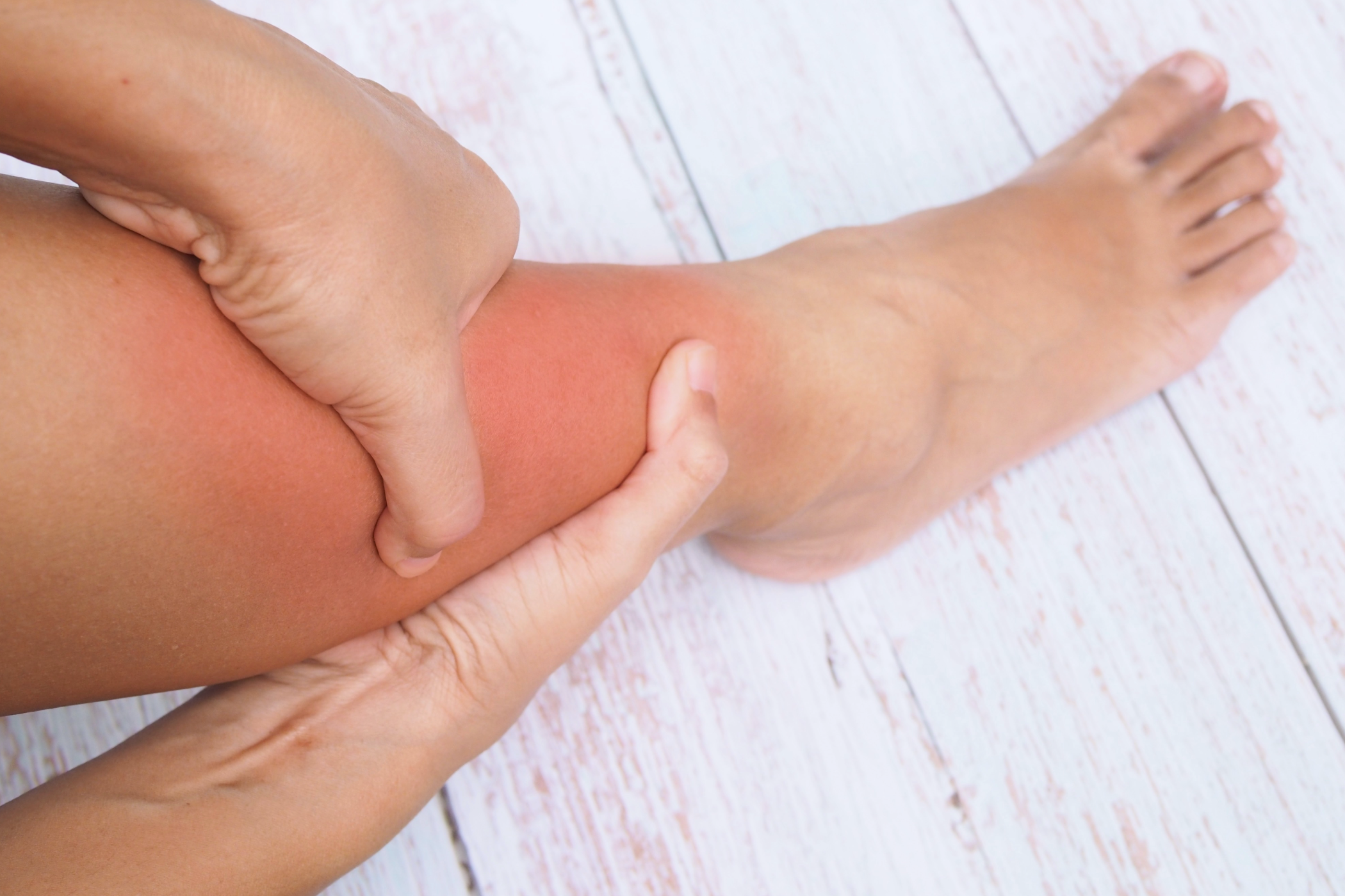 Leg Swelling Clot