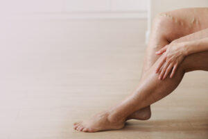 Older person's legs after seeking treatment for venous leg ulcers in Portland, OR