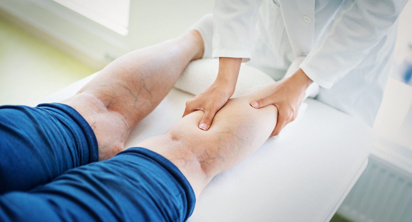 Vein specialist examines a patient’s leg with visible varicose veins during an in-office evaluation.